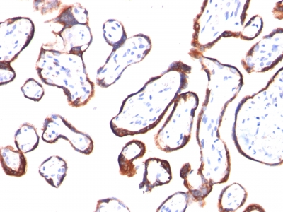 FFPE human placenta sections stained with 100 ul anti-HCG-beta (clone HCGb/54) at 1:200. HIER epitope retrieval prior to staining was performed in 10mM Citrate, pH 6.0.